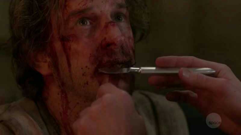 It's sad to see him like that. I really missed him :(
I can't wait for him to get back to his old self!
PS : Where is Cas????