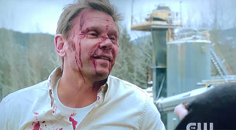 🙄🤨😆🙃
Nick: C’mon, Sam. Nobody stays dead 💀 anymore. You know that.
Seems true a lot on “Supernatural”; always on “Gotham”; and never on “The Game of Thrones.” 😆😂🤣